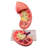 Model ledviny s nadledvinou dvakrát zvětšený, dvoudílný