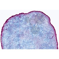 Claviceps purpurea, Paličkovice nachová