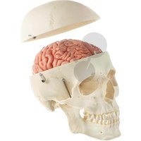 Lebka muže s mozkem rozložitelným na 8 částí, SOMSO