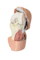 Hluboká disekce pokrčeného kolenního kloubu