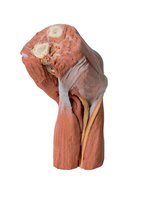 Loketní jamka - svaly, velké nervy a brachiální tepna