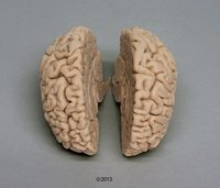 Lidský mozek, skutečný odlitek, pro lebku 4710
