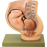 Pánev s dělohou v 9. měsíci těhotenství