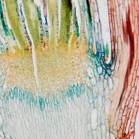 Mikroskopické preparáty – školní sada č. 3, 25 ks